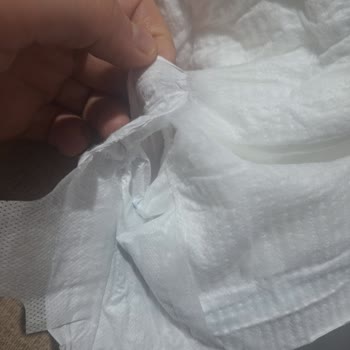 Molfix 5 Numaralı Bebek Bezinde Bantların Pamuk Kısmına Yapışması Ve Parçalanması