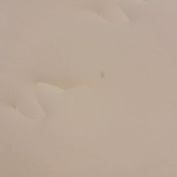 Yanıltıcı Bilgi Ve Lekeli Ortopedik Yatak İadesi Gerekiyor