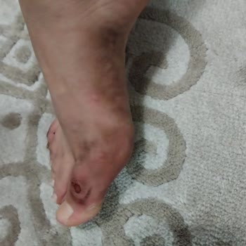 Süet Terlikte Yara Ve Boya Akar, Mağaza Normal Diye Reddetti