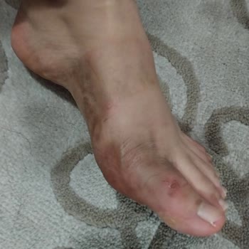 Süet Terlikte Yara Ve Boya Akar, Mağaza Normal Diye Reddetti
