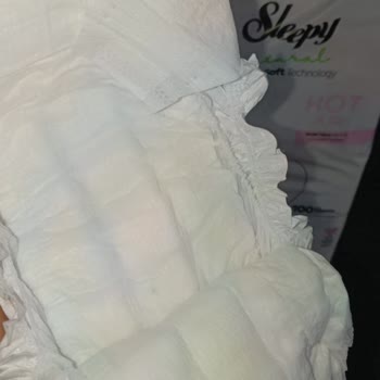 Sleepy Bebek Bezinde Yabancı Madde Ve Yetersiz Telafi