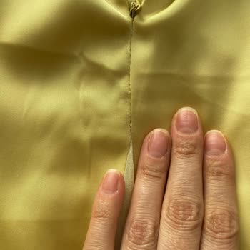 Zara'dan Gelen Lekeli Ve Hasarlı Elbise Şikayeti