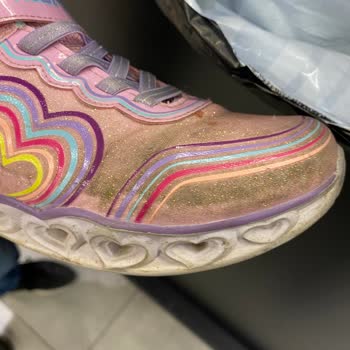 Skechers Çocuk Ayakkabısında 3 Ayda Yırtılma Ve Garanti Reddi