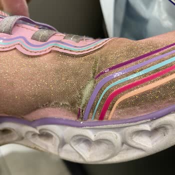 Skechers Çocuk Ayakkabısında 3 Ayda Yırtılma Ve Garanti Reddi