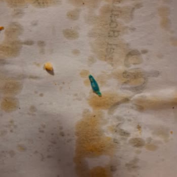 Yemek İçinden Çıkan Plastik Parça Sağlık Riski Ve Ücret İadesi Talebi