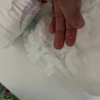 Molfix Bebek Bezinde Yırtık Paket Ve Tuz Benzeri Kalıntı