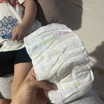 Yeni Double Soft Bebeğimde Şiddetli Cilt Döküntüsü Ve Markadan Hiç Cevap Gelmedi