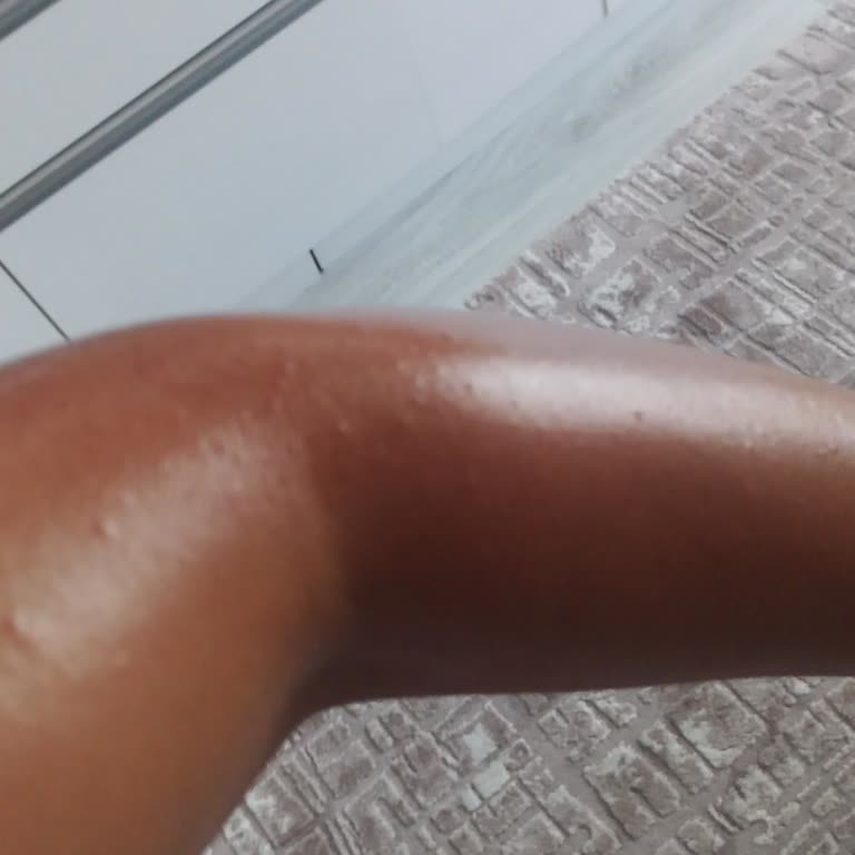 Migros 'tan Aldığım Parfümün Zarar Vermesi