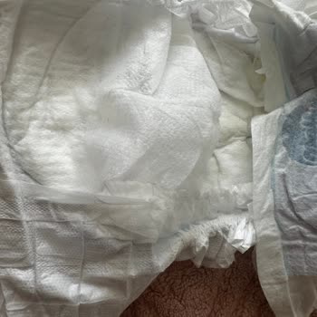 Molfix 5 Numaralı Bebek Bezinde Belirgin Defolu Üst Kısım