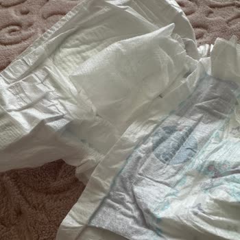Molfix 5 Numaralı Bebek Bezinde Belirgin Defolu Üst Kısım
