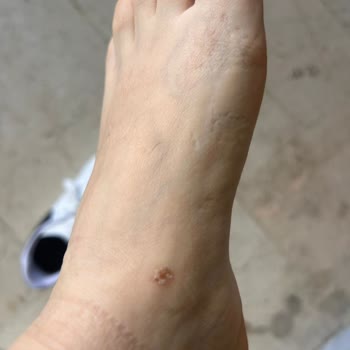 Ayaklarım Su İçinde Kaldı: Kalitesiz Terlikte Yaralanma Ve Değişim Talebi