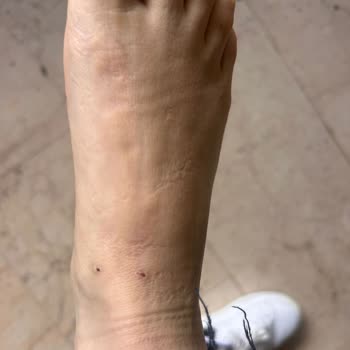 Ayaklarım Su İçinde Kaldı: Kalitesiz Terlikte Yaralanma Ve Değişim Talebi