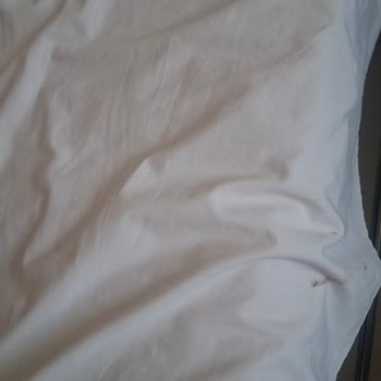 Gazi Yaşargil Eğitim Araştırma Hastanesi Acil Durumda Hastanın 42°c Ateşi İhmal Edildi