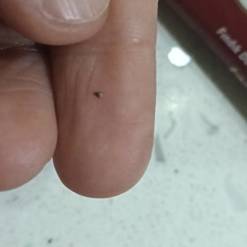 Tadelle Çikolatası İçinde Metal Parça Bulunması Ve Şirketin Cevapsız Kalması