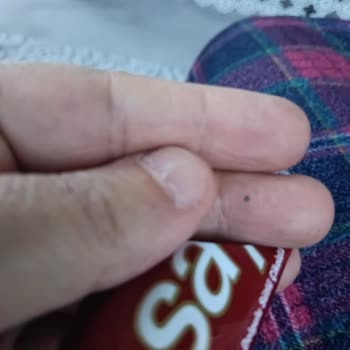 Tadelle Çikolatası İçinde Metal Parça Bulunması Ve Şirketin Cevapsız Kalması