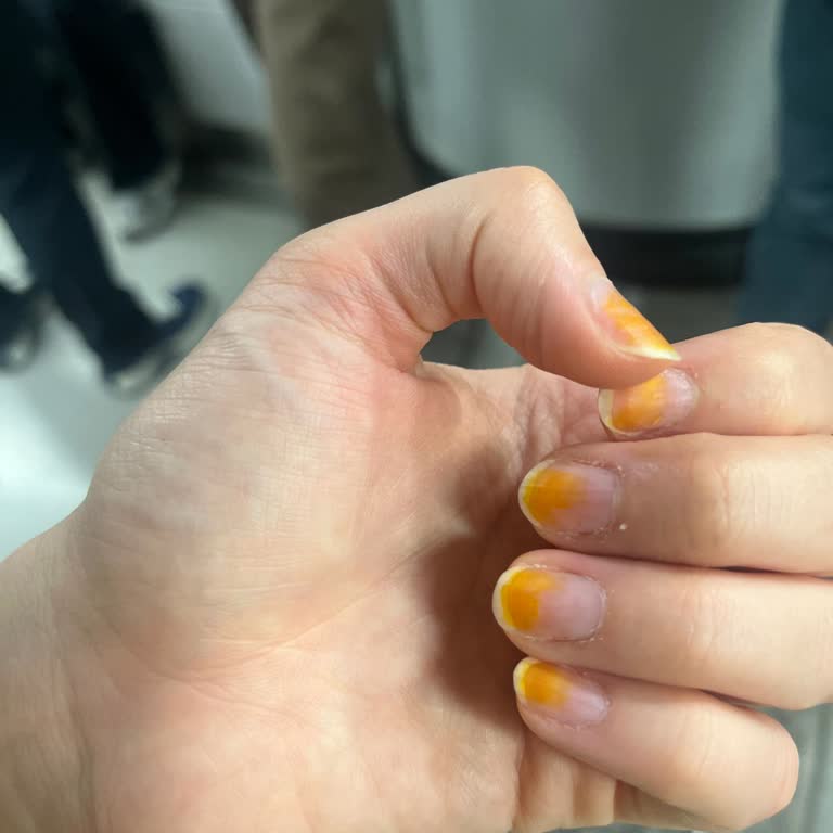 Flormar Nar Çiçeği Rengi Oje Turuncu Lekeler Bıraktı Ve Kanserojen Madde Şikayet Ediliyor