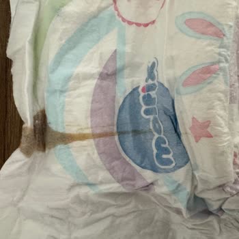Molfix Bebek Bezlerinde Lekeler Ve Değişim Talebi