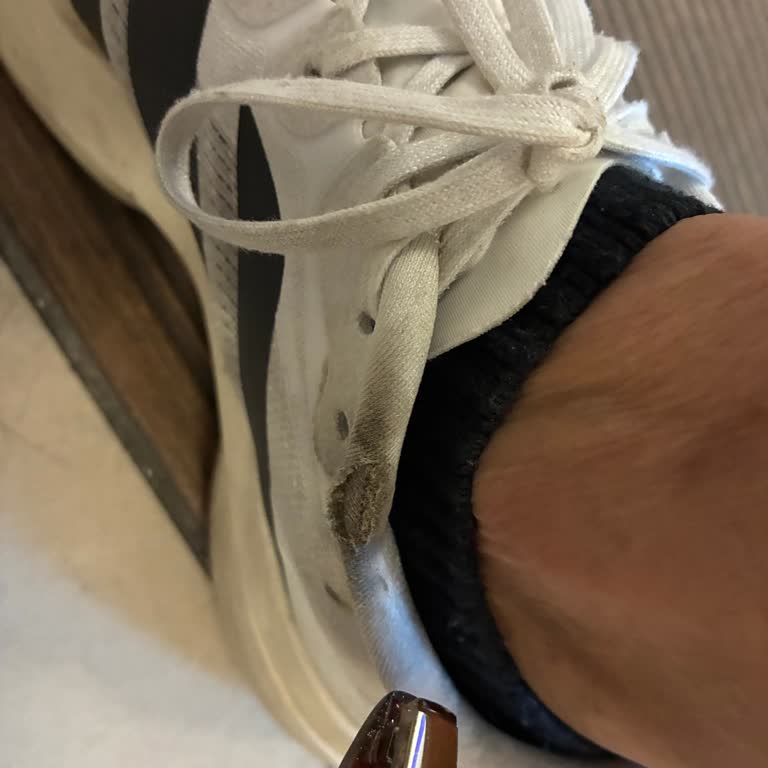 Amazon Üzerinden Satın Alınan Adidas Kadın Ayakkabısında Kısa Sürede Bilek Aşınması