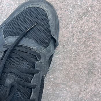 Skechers Ayakkabısının Dikiş Açması Ve Amazon İade Politikasıyla İlgilenmemesi