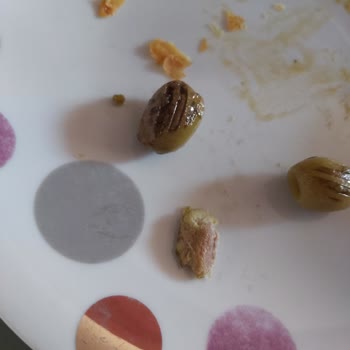 Çekirdeksiz Dediği Zeytin İçinde Çekirdek Çıktı, Diş Kırıldı Ve Sağlık Sorunu Yaşandı