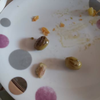 Çekirdeksiz Dediği Zeytin İçinde Çekirdek Çıktı, Diş Kırıldı Ve Sağlık Sorunu Yaşandı