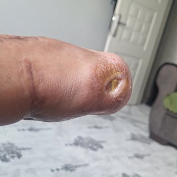 Özel Ortadoğu Hastanesi | Adana Kayıt Dışı Nakit Ücret Tahsilatına Karşı İade Talebi