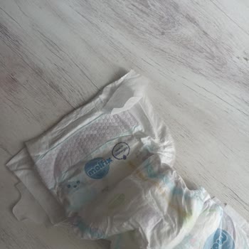 Molfix 4 Numara Bebek Bezlerinde Bantların Sürekli Kopması