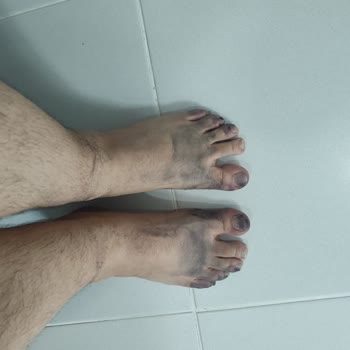 Ayakkabı Temizleyicisi Renk Solması Ve Kalıcı Hasar Yaptı, Şirket Boyama İle Gizlemeye Çalıştı