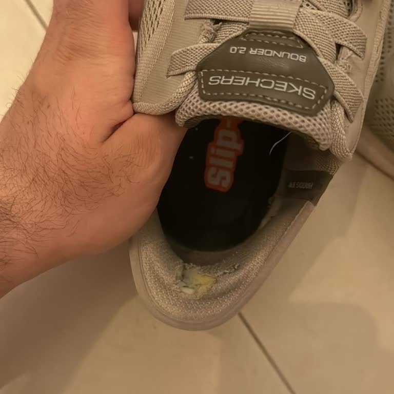 Skechers Ayakkabısının Arka Kısmı Hızla Açıldı, Kalite Güveni Sarsıldı