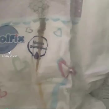 Molfix Bebek Bezinin İçinde Çıkan Belirsiz Yumuşak Bir Nesne