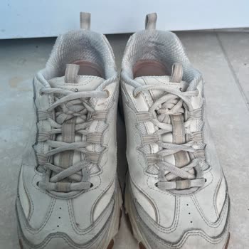 Skechers Ayakkabısında Üretim Kusuru Olmadığı İddiası Açıklama Sunulmadan Reddedildi