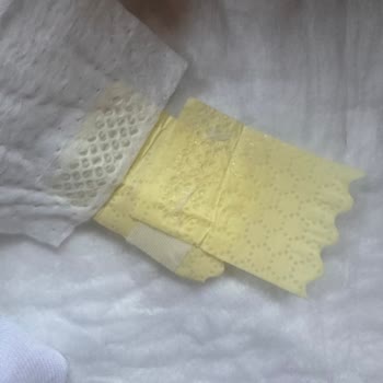 Yapışkan Bant Arızası Nedeniyle Prima Bebek Bezinde Sürekli Sızıntı Ve Hijyen Sorunu