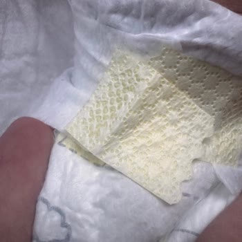 Yapışkan Bant Arızası Nedeniyle Prima Bebek Bezinde Sürekli Sızıntı Ve Hijyen Sorunu