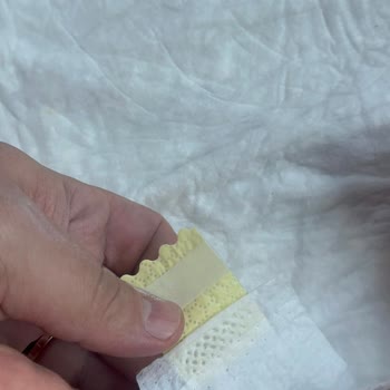 Yapışkan Bant Arızası Nedeniyle Prima Bebek Bezinde Sürekli Sızıntı Ve Hijyen Sorunu