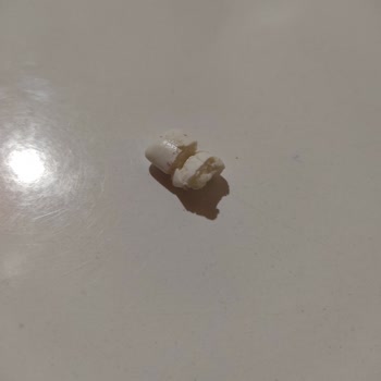 Bozuk Ülker Oneo Çilekli Sakız İçin İade Talebi