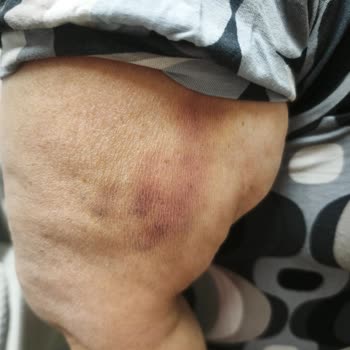 Randevu Kaosu Ve Yetersiz İlgi Nedeniyle Ödenen 10 Bin TL’nin İadesi