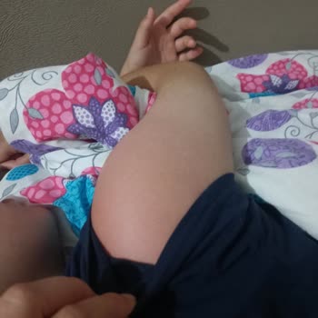 Mustela Güneş Kremi Çocuğumu Yanıttı, Geri Ödeme Talep Ediyorum