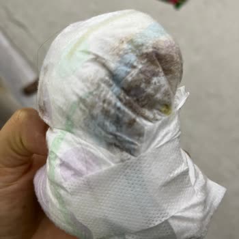 Sık Sızdırma Nedeniyle Bebek Bezinde Sürekli Kıyafet Ve Yatak Değiştirme Zorluğu
