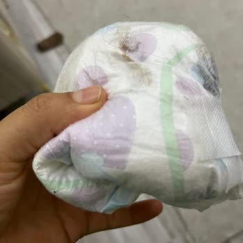 Sık Sızdırma Nedeniyle Bebek Bezinde Sürekli Kıyafet Ve Yatak Değiştirme Zorluğu