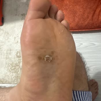 Kemal Tanca Mağazasındaki Deri Ayakkabıda Alerjik Reaksiyon Ve Cevapsız Hizmet