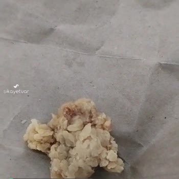 Popeyes Kıl Çıkan Nugget