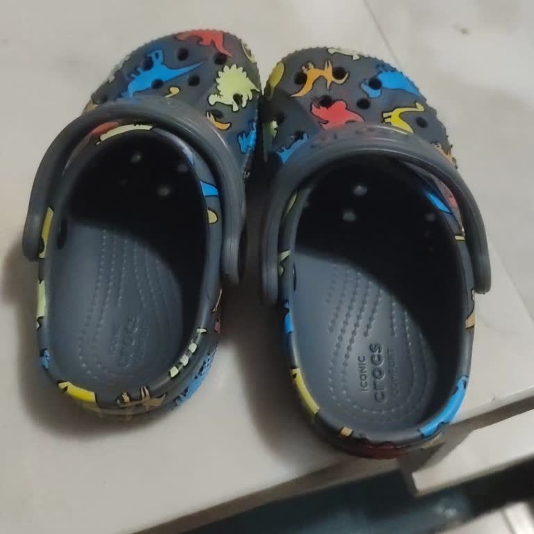 Crocs Terliği Çocuğumun Ayağını Yara Bıraktı, Mağaza Çözüm Sunmadı