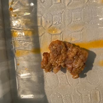 Keskinoğlu Yaprak Tavuk Dönerde Saç Ve Deri Parçası Bulundu
