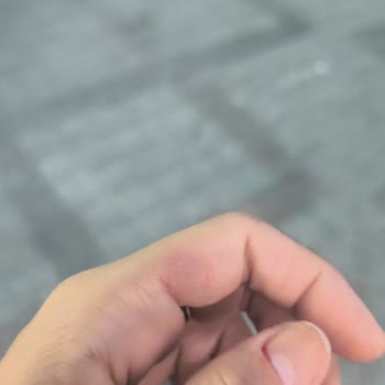 Bakırköy Fanes Nail Bar’da Manikür Sırasında Tırnak Kesildi Ve Kanama
