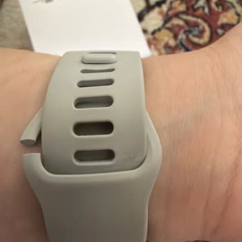 Garanti Kapsamında Kordon Kopması: Redmi Watch 5 Active İçin Ücretsiz Onarım Talebi