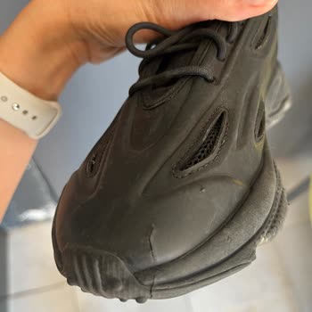 Sağ Ayakkabıda Açılma Ve Adidas'ın Hatalı Tutumu