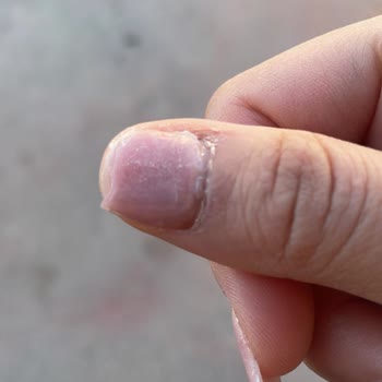 Protez Tırnak Uygulamasında Sürekli Kırılma Ve Ücret İadesi Talebi