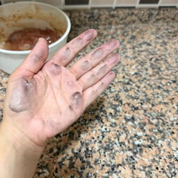 Tencere Setinde Boya Dökülmesi Ve Sağlık Endişesi Ve Satıcıdan Cevap Yok