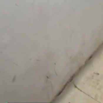 Gazi Yaşargil Eğitim Araştırma Hastanesi Temizlik Hijyen Çök Kötü Durumda