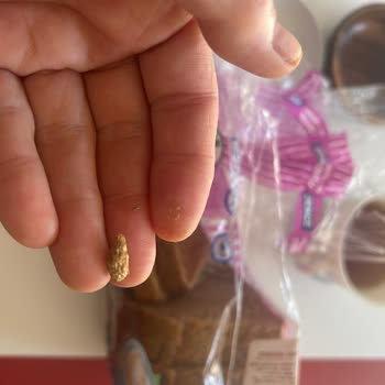 UNO Denge Ekmeğinde Sert Yabancı Cisim Ve Özür Talebi